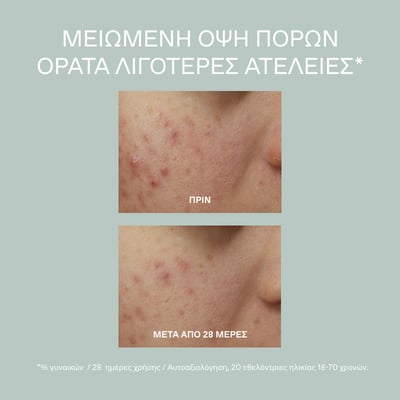 Olympus Tea Purifying Cleansing Gel 400ml